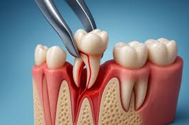 Crowns and bridges in lucknow, Best dentures in lucknow, Best maxillofacial surgeon in lucknow, Best dentist in Lucknow, dentist in Lucknow